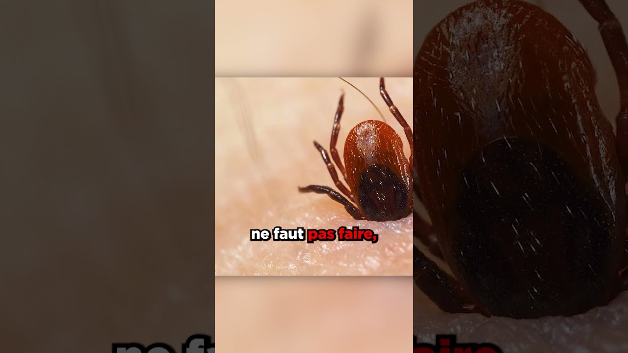 Voici Comment Enlever Un Tique